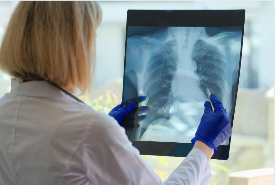 A medical professional examining an X-ray with a focus on the chest area, using a magnifying glass.