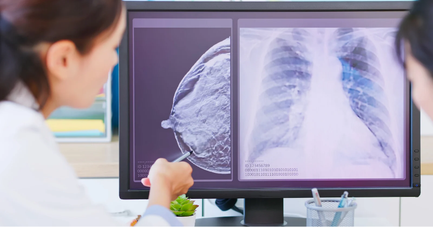 This is an image featuring a medical professional at a workstation with a monitor displaying an X-ray of a human chest, viewed by a patient who appears to be a woman. The setting suggests a clinical environment, and the focus is on medical imaging and healthcare.