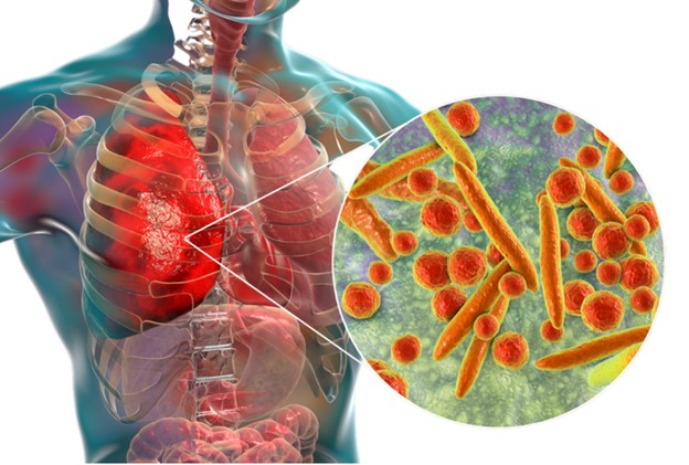 The image depicts a detailed 3D illustration of the human body with an emphasis on the respiratory system, showcasing how viruses can enter and affect the lungs, alongside a microscopic view of coronavirus particles in comparison to healthy cells.