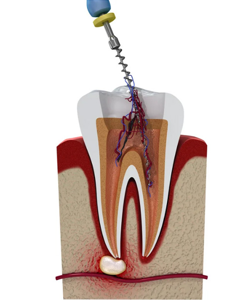 mediDental care | Cosmetic Dentistry, Dental Bridges and Sleep Apnea