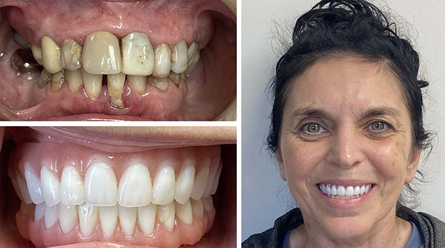 mediDental care | Dentures, Teeth Whitening and Root Canals