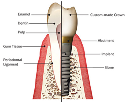 mediDental care | Oral Surgery, Implant Dentistry and Emergency Dentist