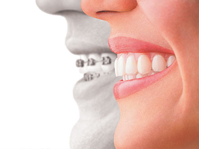 mediDental care | Emergency Dentist, Ceramic Crowns and Teeth Whitening