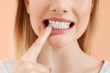 mediDental care | Oral Surgery, All-on-6 and Veneers